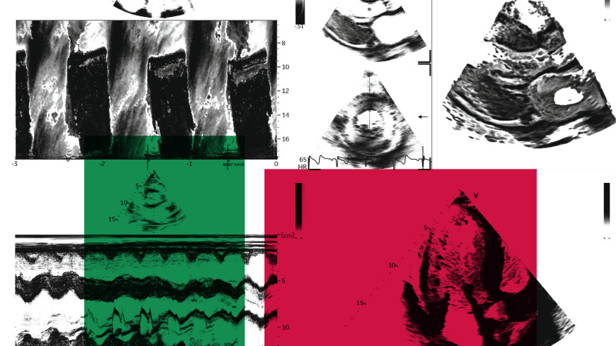 Grafik Deutscher Echokardiographie-Kongress