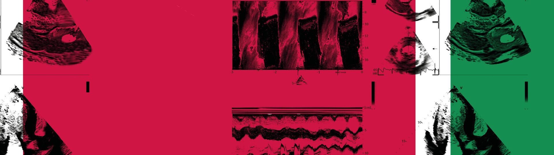 Kongress-Grafik DEK