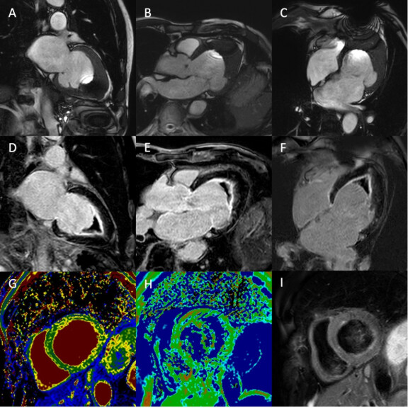 Kardio-MRT-1zu1-576x576