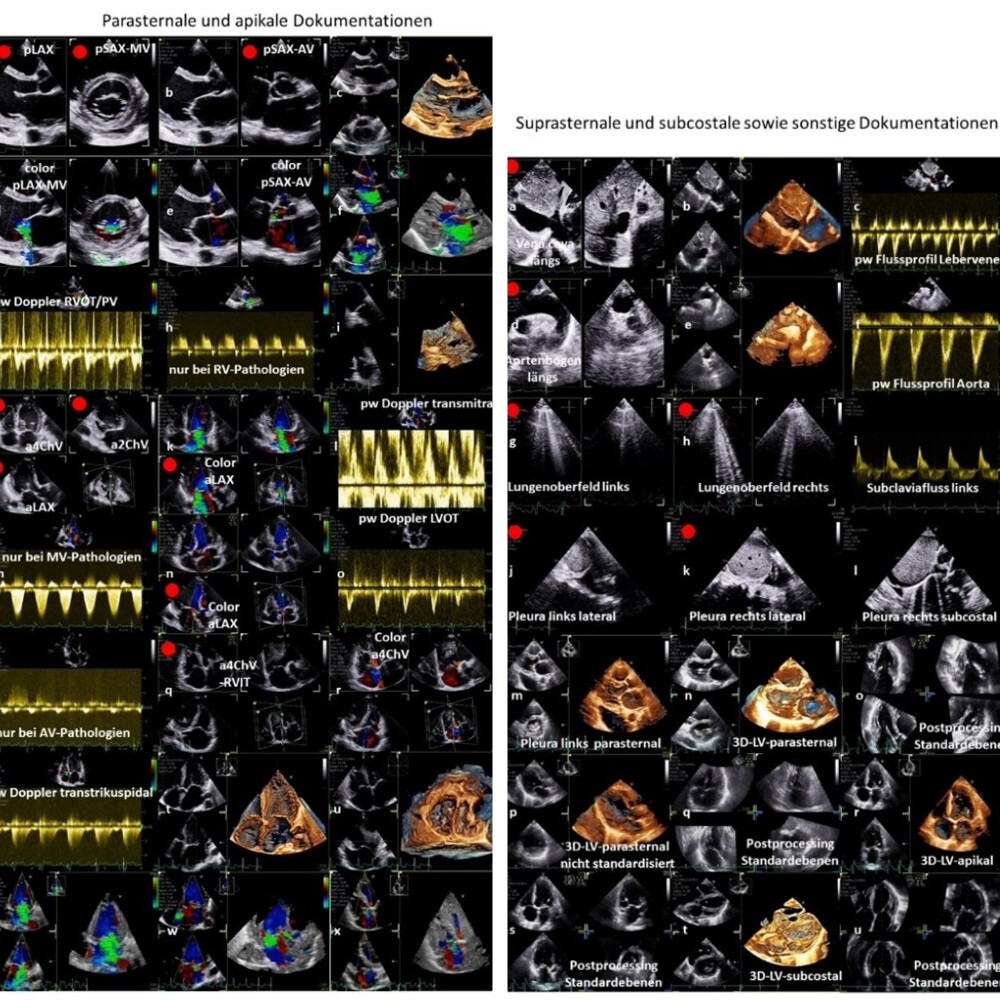 qd-manual-echokardiographie-1