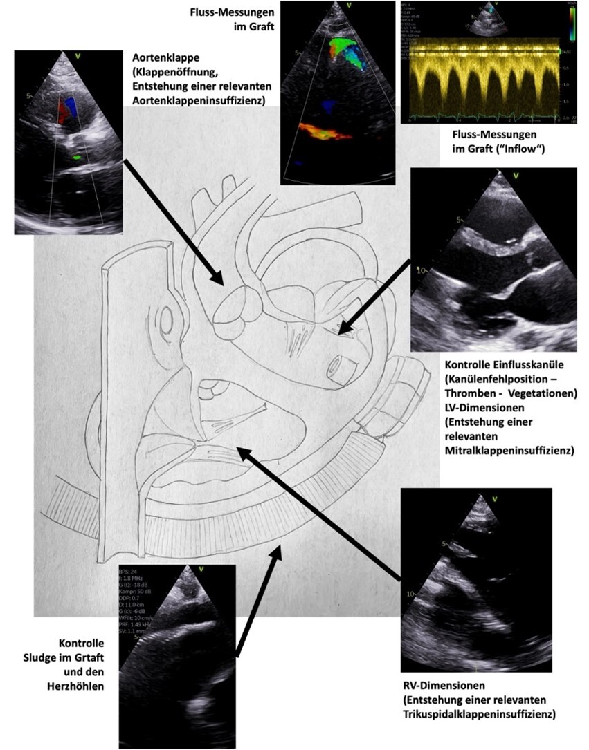 qd-manual-echokardiographie-2