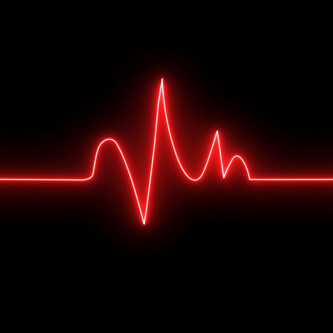 EKG-Kurve