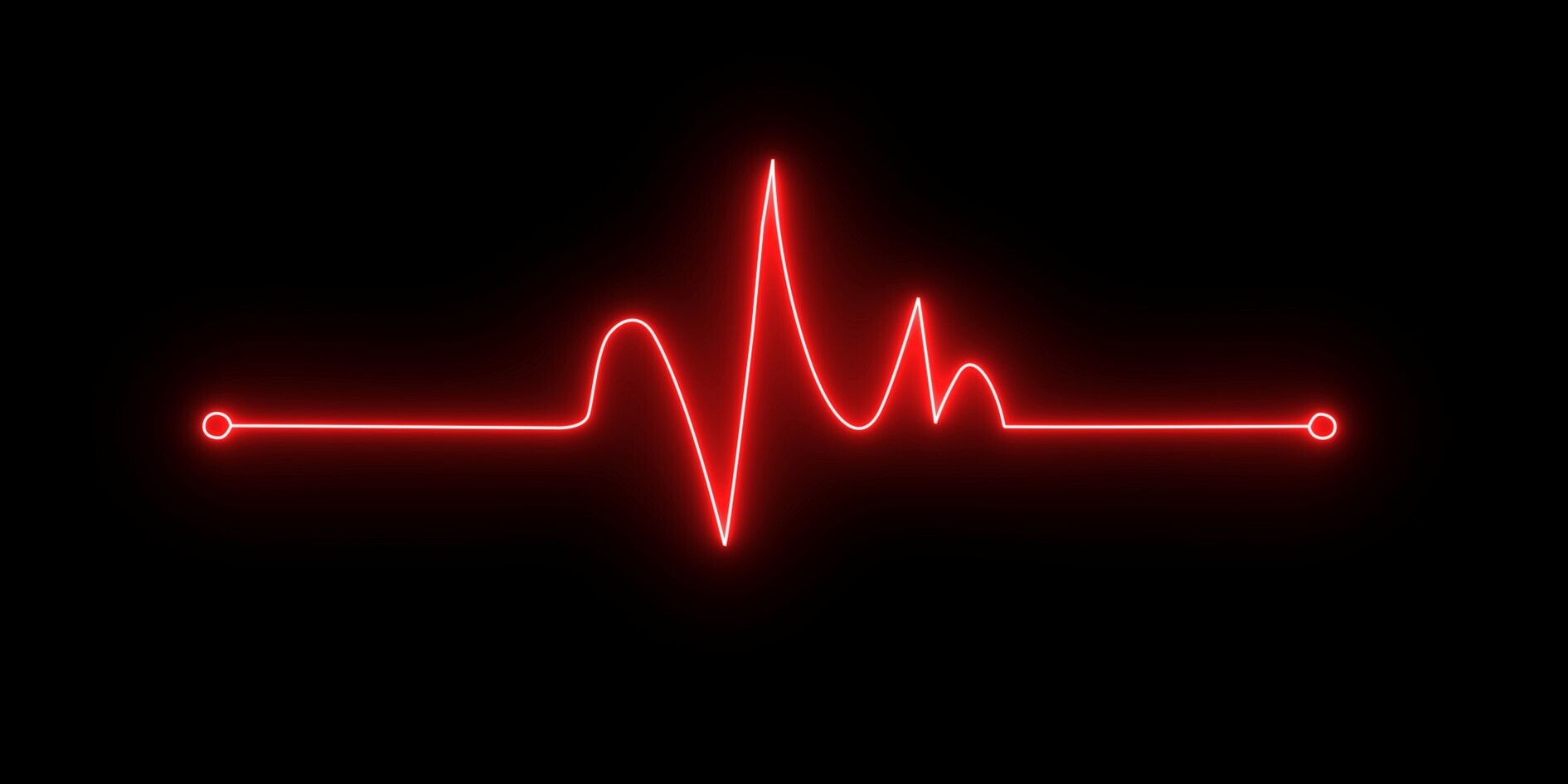 EKG-Kurve
