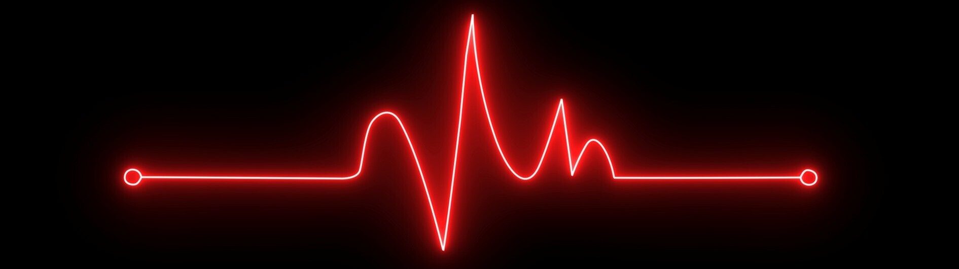 EKG-Kurve