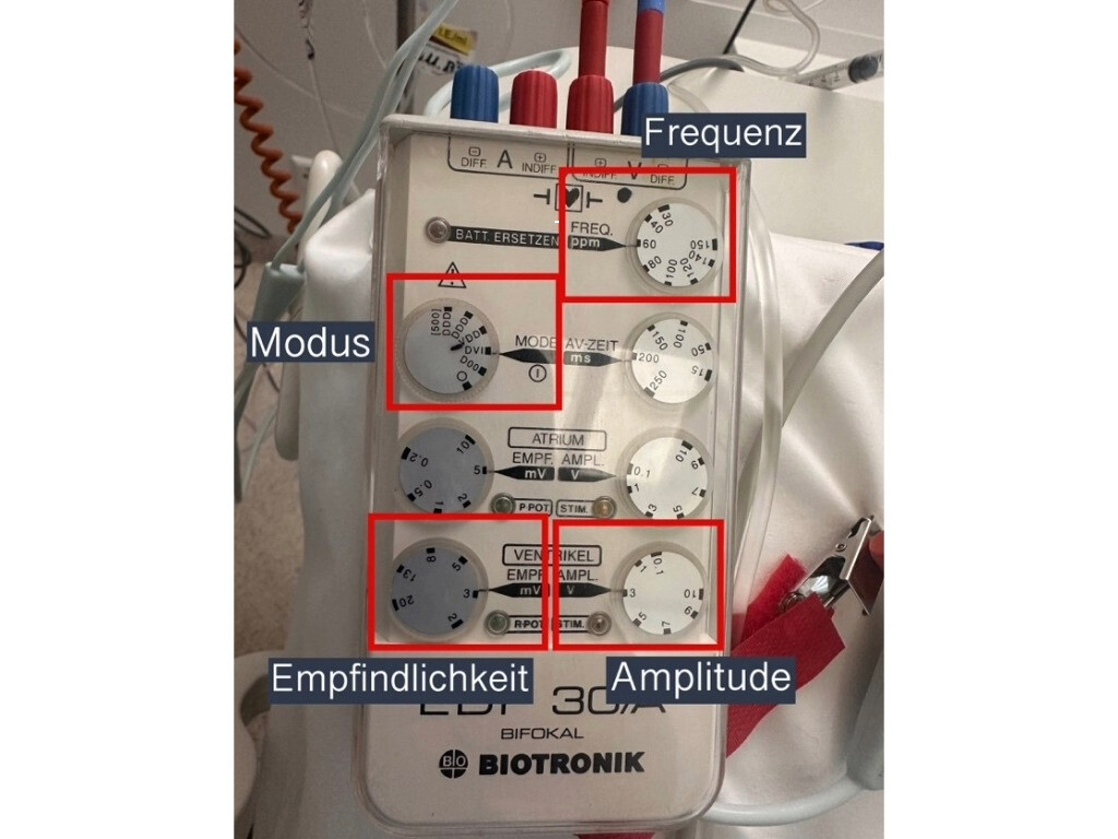 Externer Herzschrittmacher mit Einstellungsmöglichkeiten