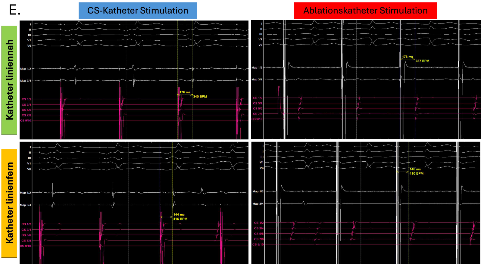 Bidirektionale Differentialstimulation