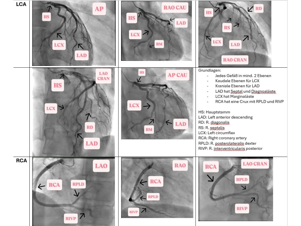 Standardprojektionen-4zu3-1024x768