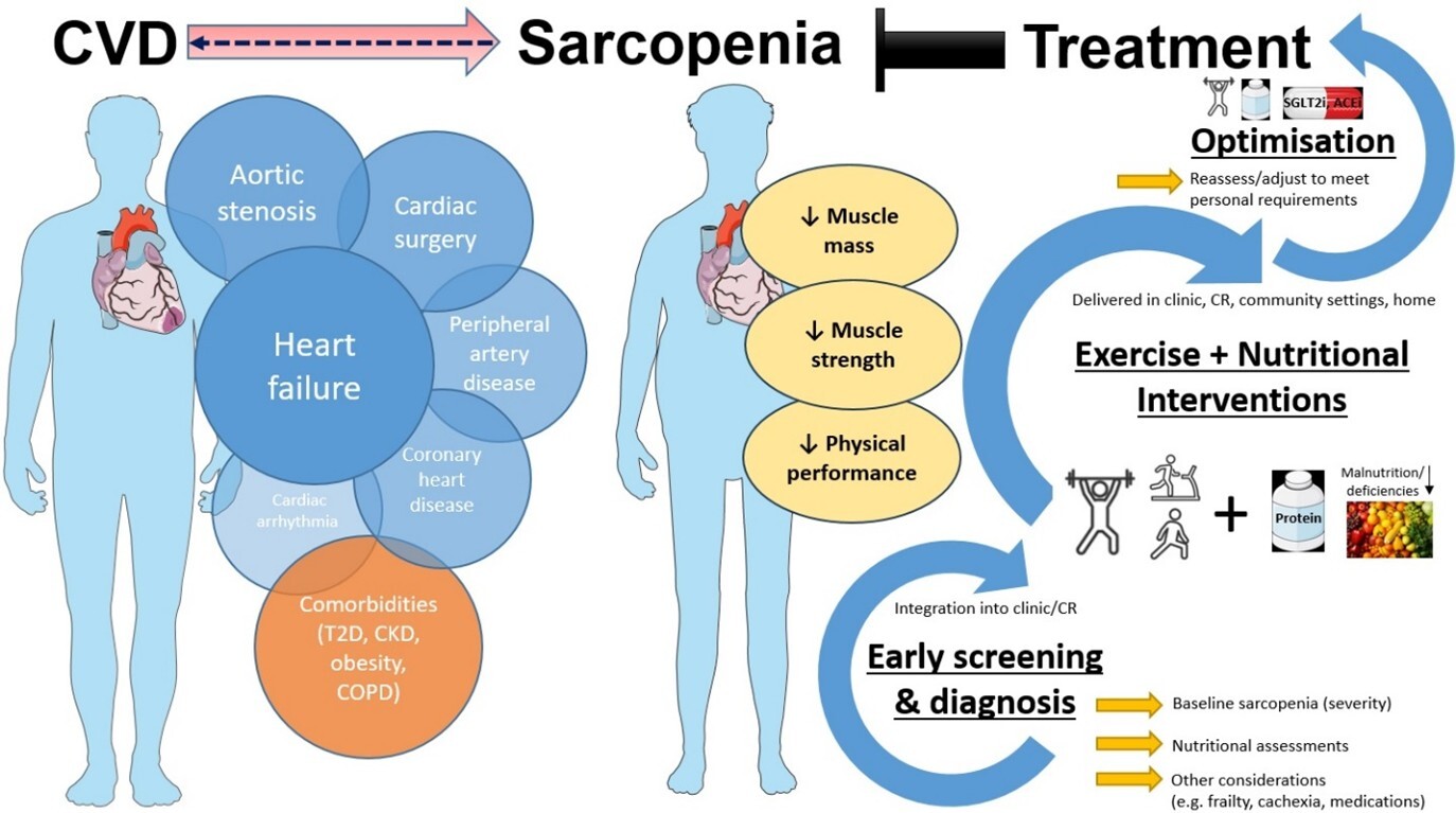 cvd-sarcopenia-eurjpc