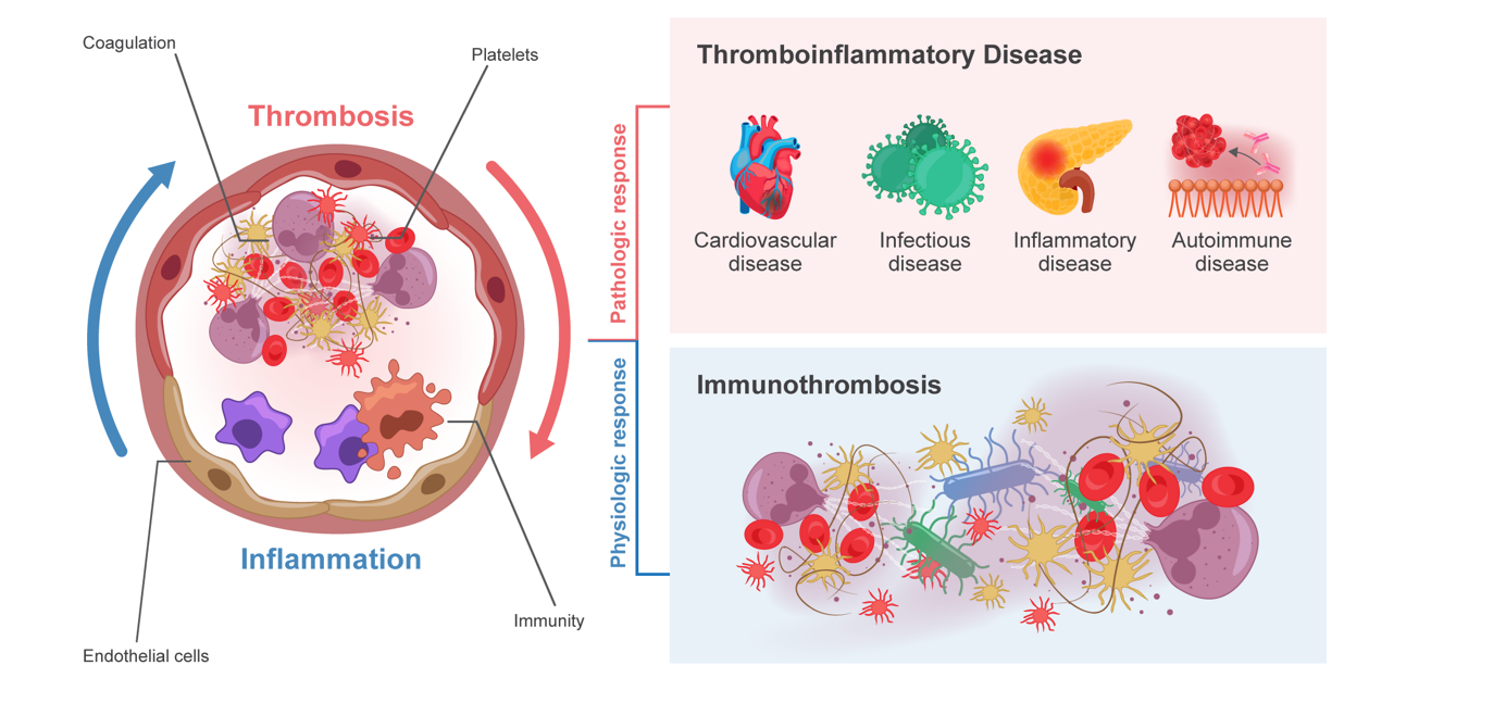 Übergang von Immunothrombose zu Thromboinflammation