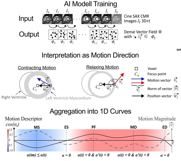 uebersicht-myocardial-motion-descriptor