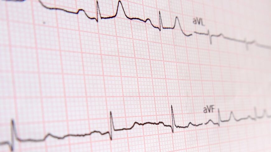 16_9-EGK-rot-shutterstock_2041379480