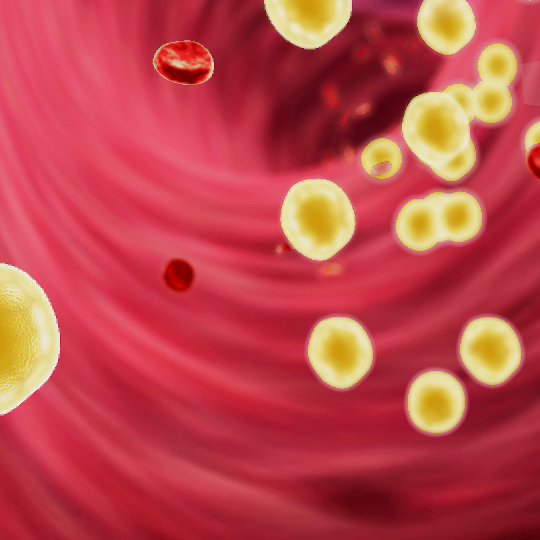 lipid-management-shutterstock-217137883-32zu9-lighter-Header