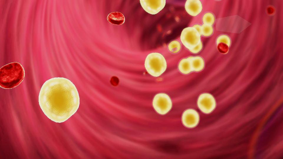 lipid-management-shutterstock-217137883-32zu9-lighter-Header