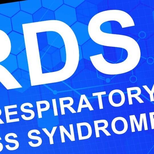 ards-acute-respiratory-distress-syndrome-shutterstock-272949410-32zu9-1920x540