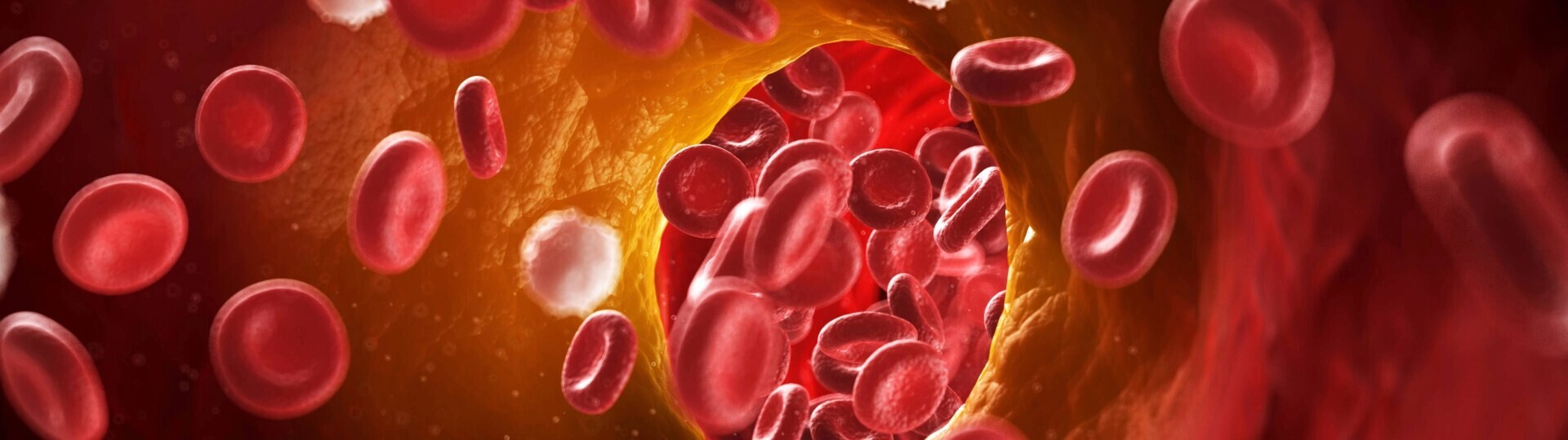 atherosklerose-shutterstock-133427786-32zu9-1920x540