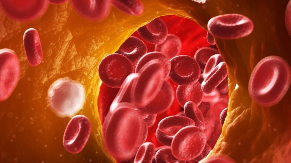 atherosklerose-shutterstock-133427786-32zu9-1920x540