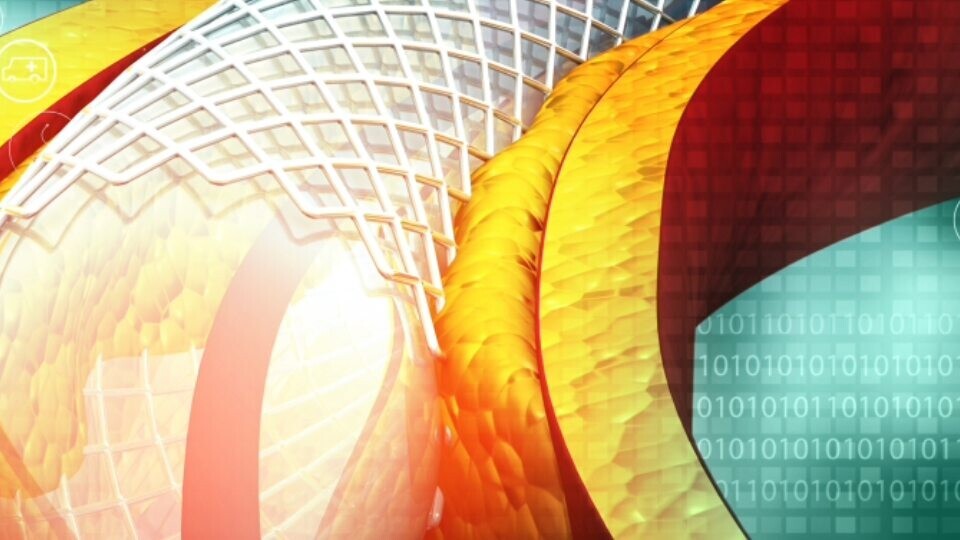 balloon-stent-shutterstock-1486417064-32zu9-1920x540