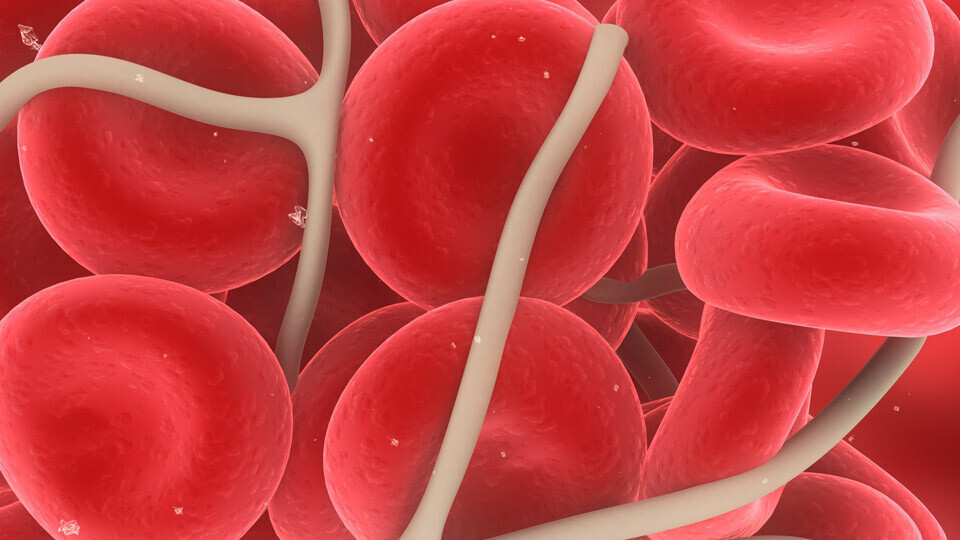 blutgerinnsel-shutterstock-53224042-32zu9-1920x540px