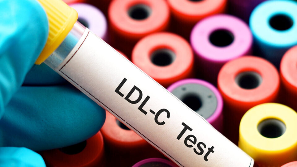 blutprobe-ldl-c-shutterstock-505935169-32zu9-1920x540px