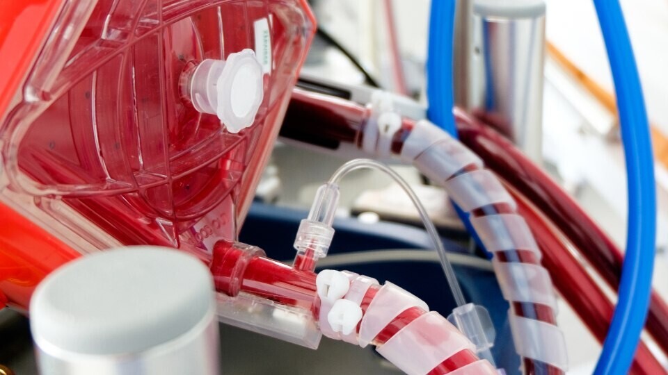 ecmo-behandlung-shutterstock-1131769253-1920x540