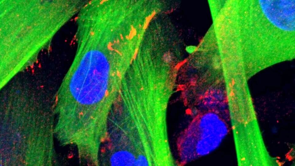 fibroblasten-shutterstock-1257335041-32zu9-1920x540a