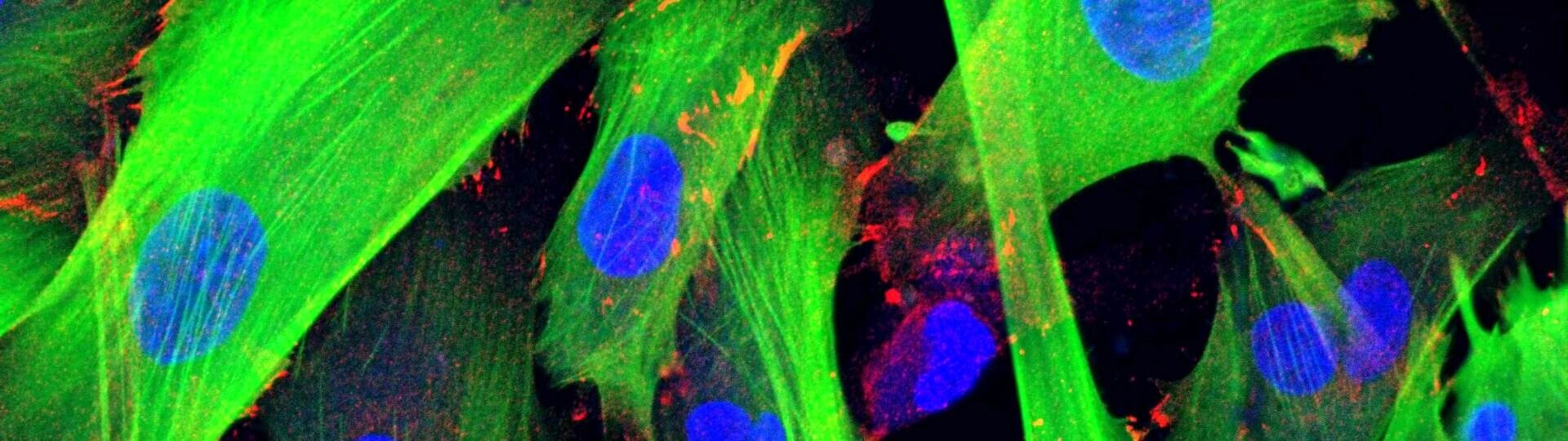 fibroblasten-shutterstock-1257335041-32zu9-1920x540a