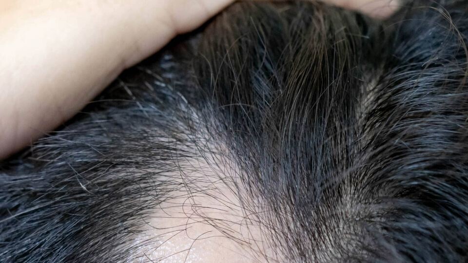 haarausfall-shutterstock-2470568683-32zu9-1920x540-komp