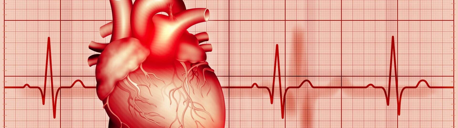 herz-ekg-shutterstock-1905995083-32zu9-1920x540