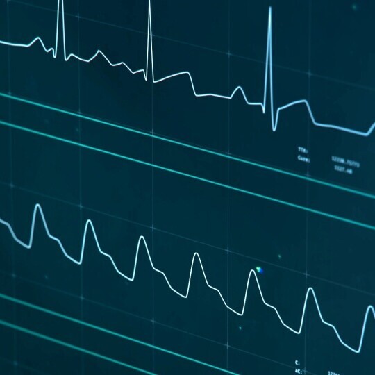 icu-monitor-ki-shutterstock-1109376020-32zu9-1920x540