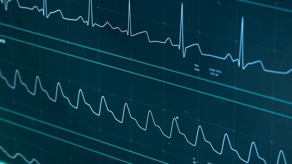 icu-monitor-ki-shutterstock-1109376020-32zu9-1920x540