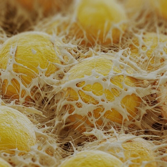 interaktion-fettzellen-herz-shutterstock-2286858577-1zu1-576x576b