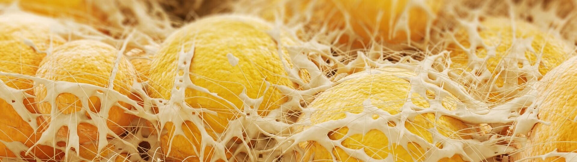 interaktion-fettzellen-herz-shutterstock-2286858577-32zu9-1920x540a