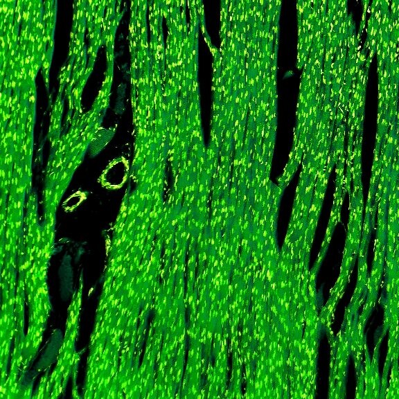 kardiomyozyten-shutterstock-629294918-1zu1-576x576a