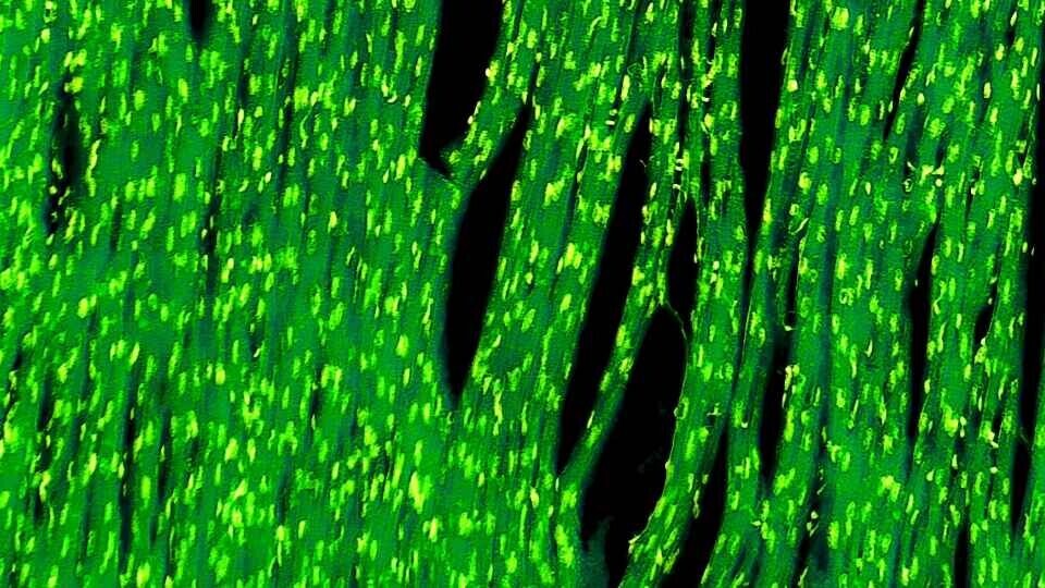 kardiomyozyten-shutterstock-629294918-32zu9-1920x540a