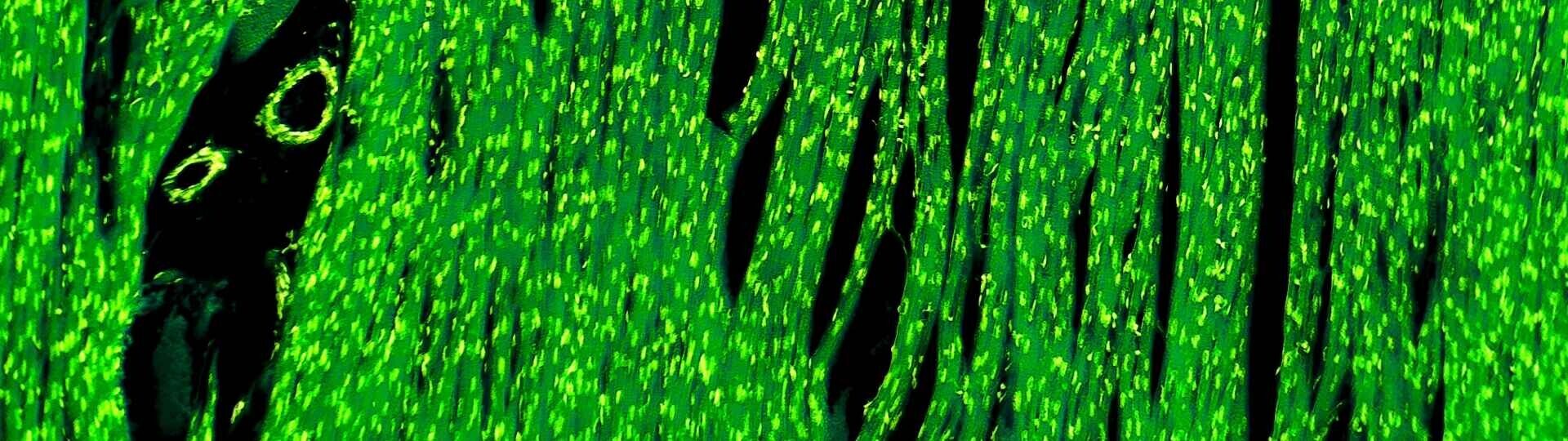 kardiomyozyten-shutterstock-629294918-32zu9-1920x540a