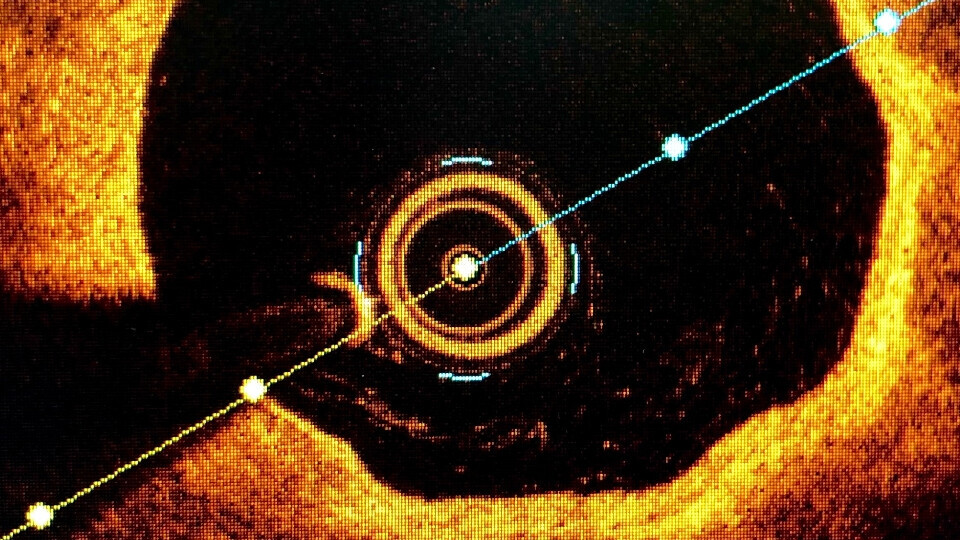 oct-intravaskulaere-bildgebung-shutterstock-2186368653-32zu9-1920x540