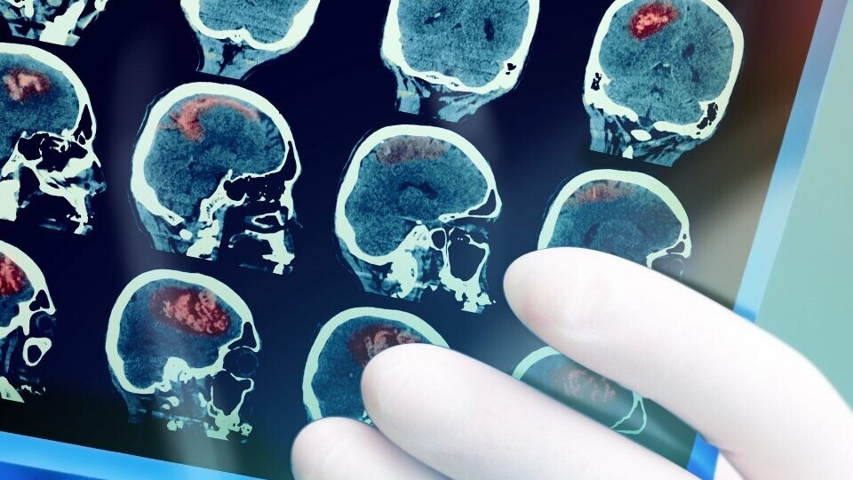 Schlaganfall-Header-Image-32zu9-1920x540