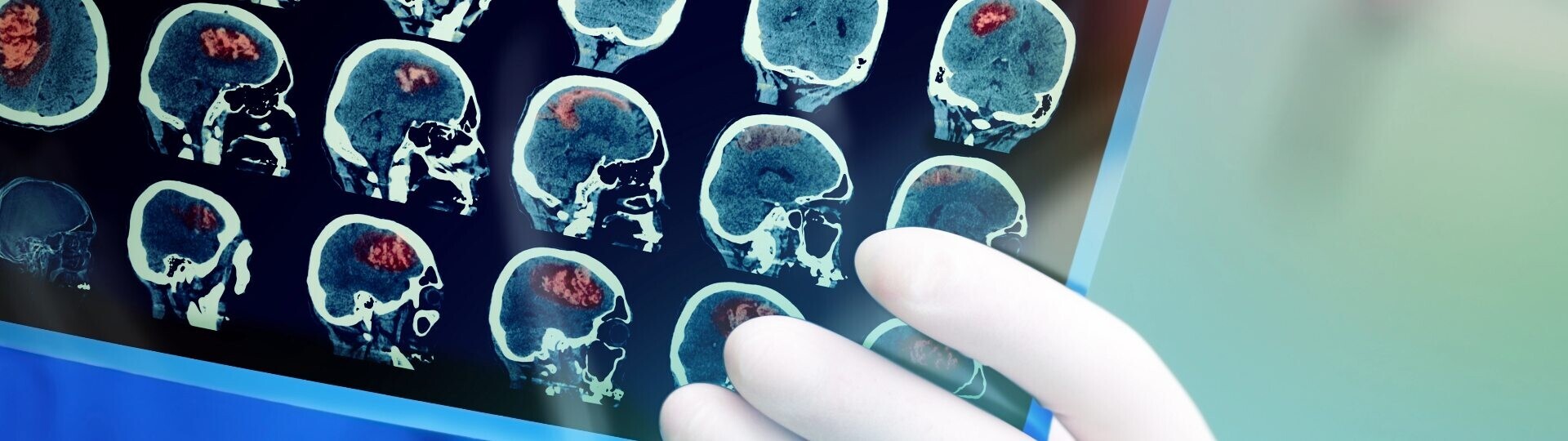 Schlaganfall-Header-Image-32zu9-1920x540