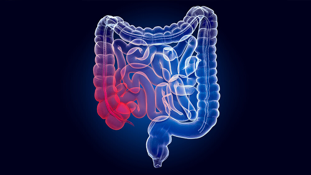 colitis-ulcerosa-herzerkrankung-1204703706_T