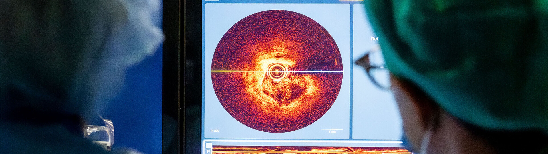 optische-kohaerenztomographie_H