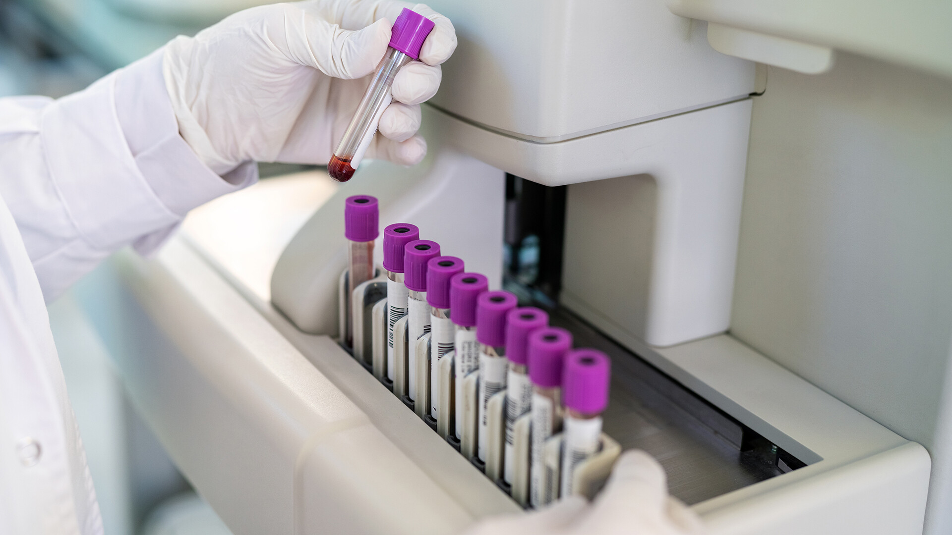 praeeklampsie-erkennen-1371706383-it