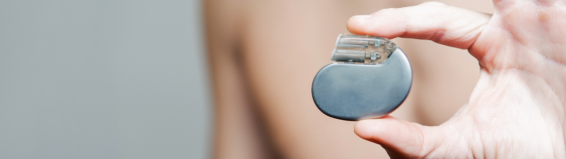 herzschrittmacher-operation-iStock-172454970-h