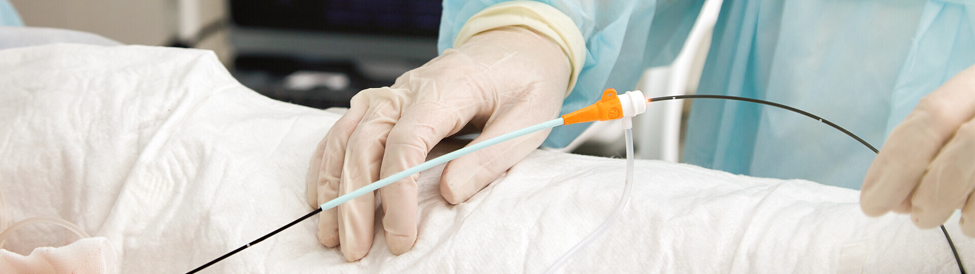 katheterablation-behandlung-iStock-1472546101-h