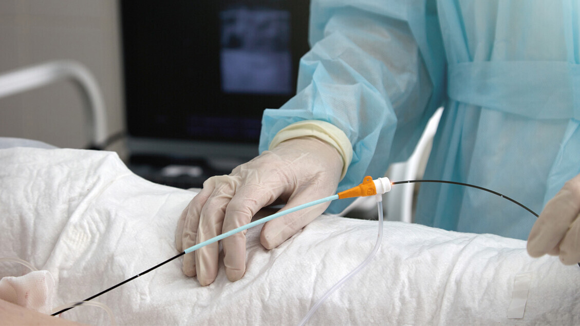 KATHETERABLATION-BEHANDLUNG-ISTOCK-1472546101-SB