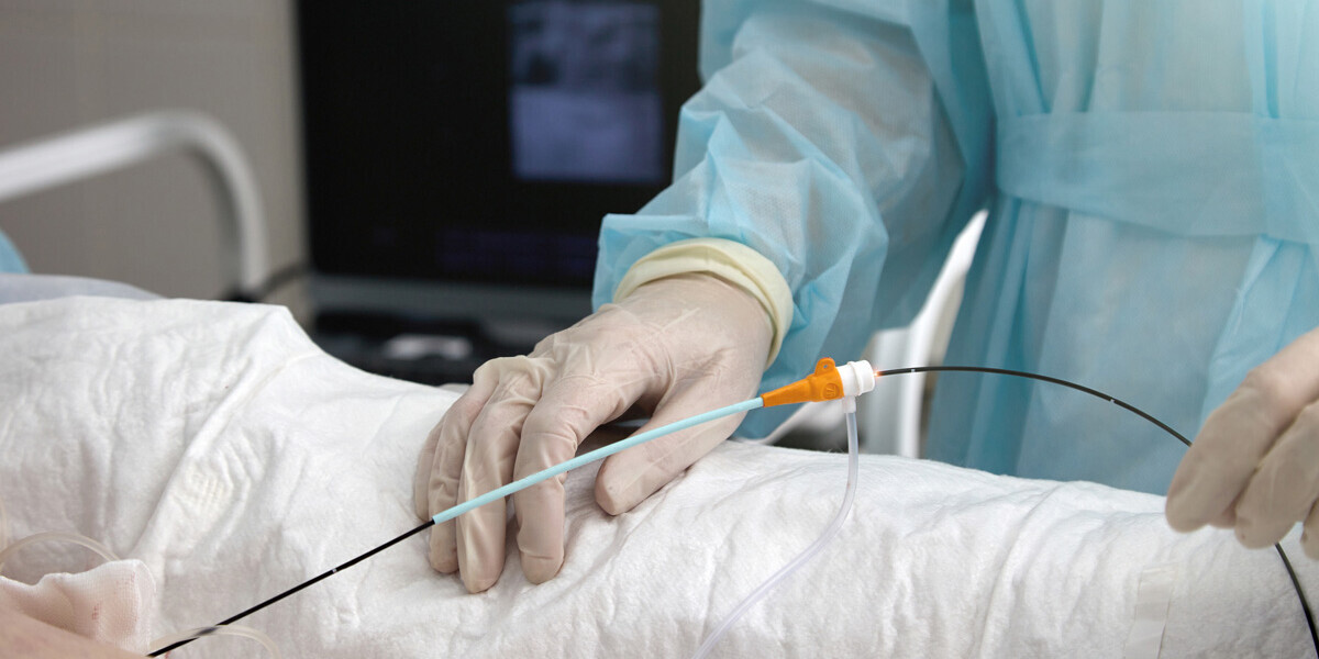 KATHETERABLATION-BEHANDLUNG-ISTOCK-1472546101-SB