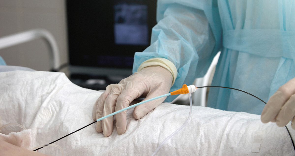 KATHETERABLATION-BEHANDLUNG-ISTOCK-1472546101-SB