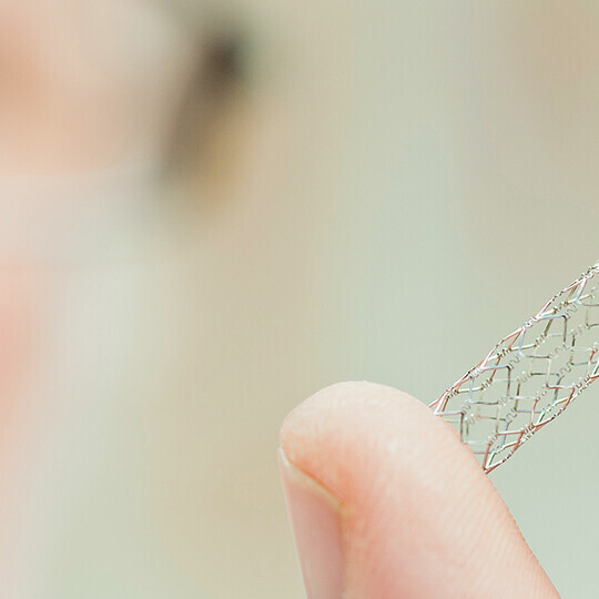 stent-implantation-181886467-h