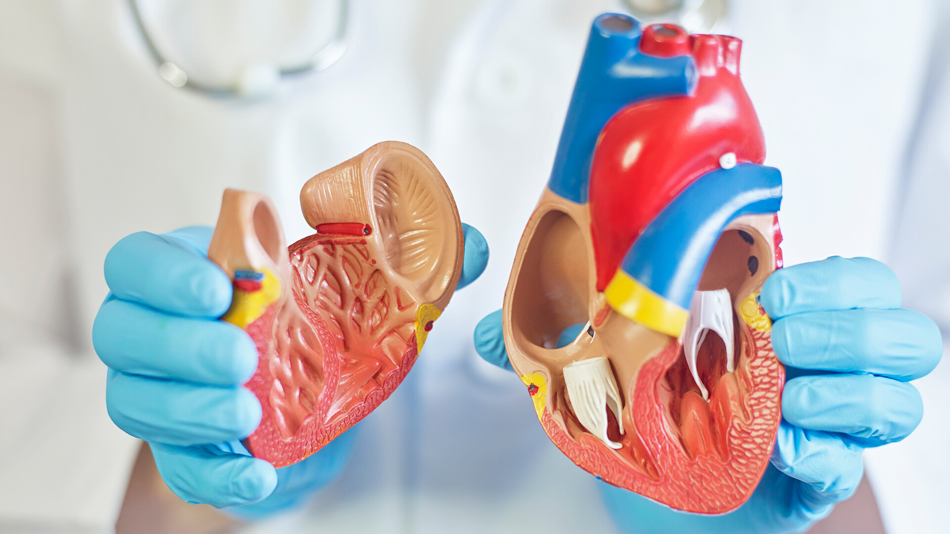 endokarditis-herzklappe-1472435238-it