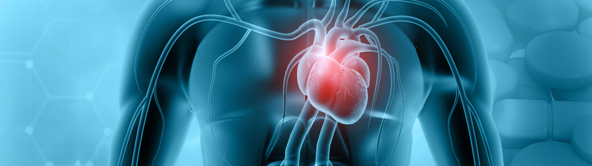 herzmuskelentzuendung-ursachen-1207222477-h