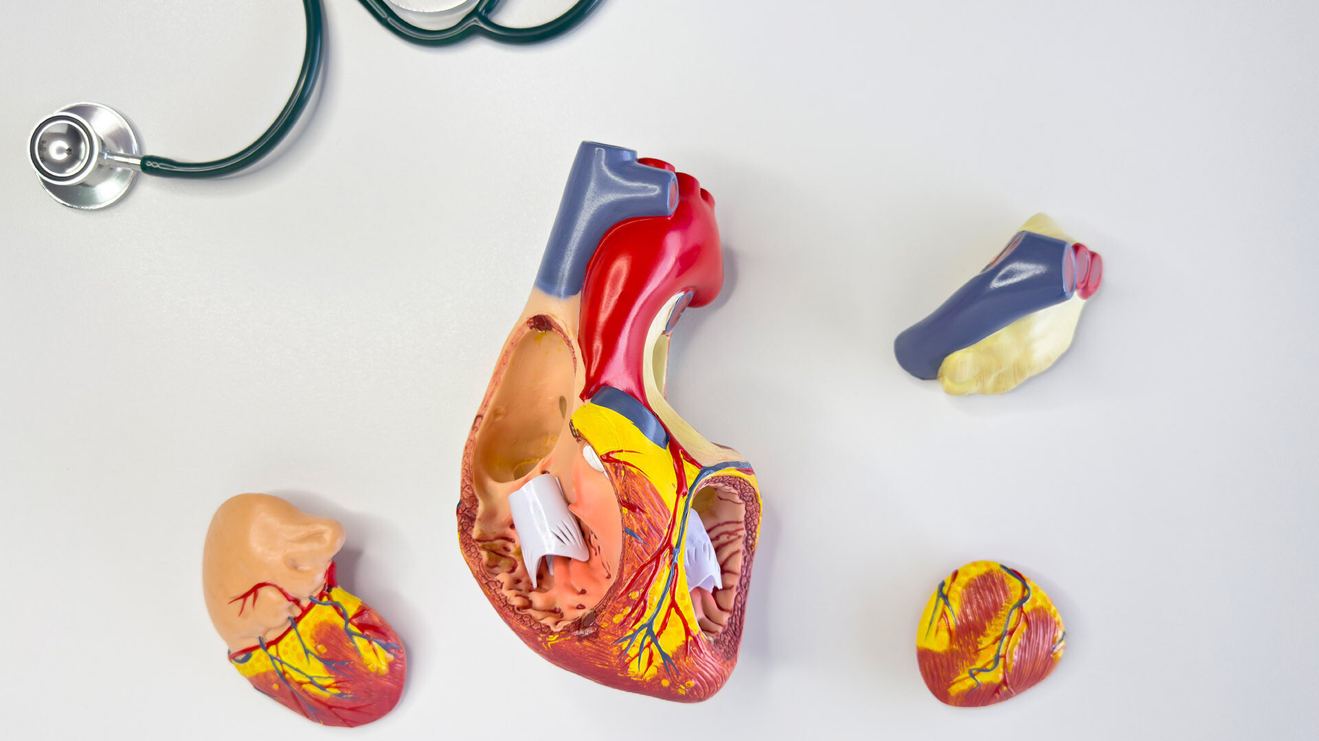 hypertensive-herzkrankheit-herzwaende-1463627936-it